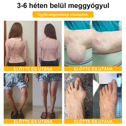 🔥Legkelendőbb丨TLOPA® Botulinum Toxin és Méhméreg Fájdalomcsillapító Csontgyógyító Krém🐝 🔥(Kifejezetten időseknek & ortopéd szakorvosok ajánlásával)🦴