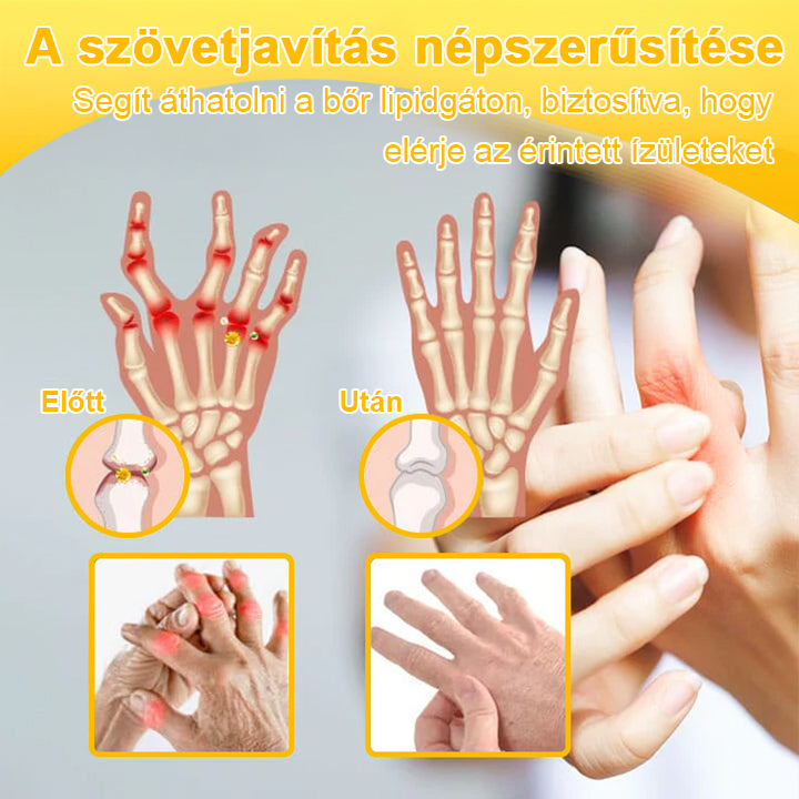 🔥Legkelendőbb丨TLOPA® Botulinum Toxin és Méhméreg Fájdalomcsillapító Csontgyógyító Krém🐝 🔥(Kifejezetten időseknek & ortopéd szakorvosok ajánlásával)🦴
