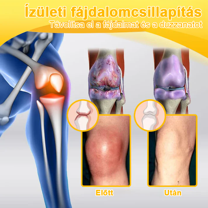 🔥Legkelendőbb丨TLOPA® Botulinum Toxin és Méhméreg Fájdalomcsillapító Csontgyógyító Krém🐝 🔥(Kifejezetten időseknek & ortopéd szakorvosok ajánlásával)🦴