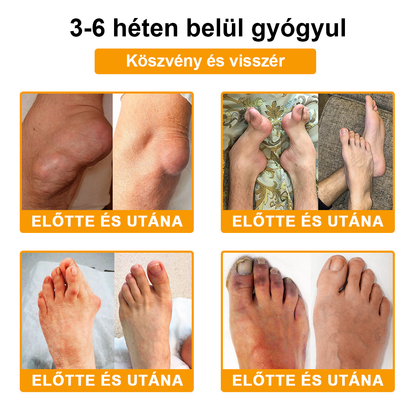 🔥Legkelendőbb丨TLOPA® Botulinum Toxin és Méhméreg Fájdalomcsillapító Csontgyógyító Krém🐝 🔥(Kifejezetten időseknek & ortopéd szakorvosok ajánlásával)🦴
